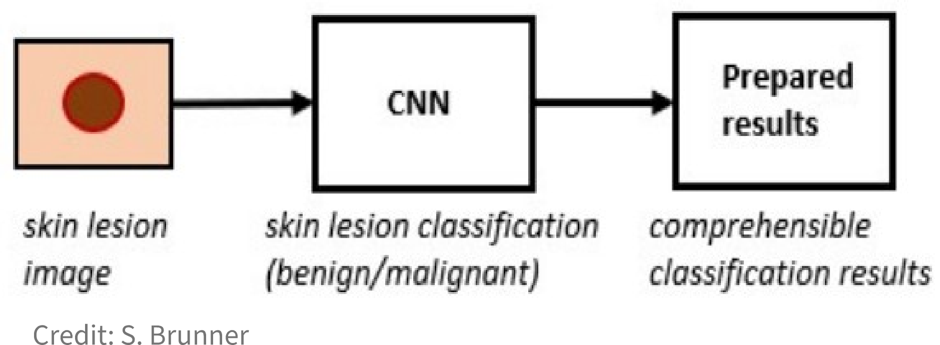 skin_lesion_classifier_scheme.png